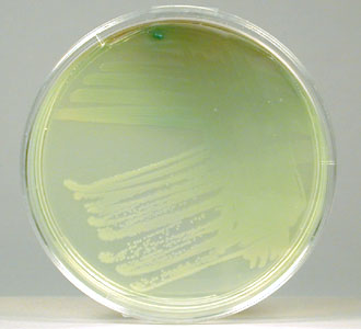 pigment-of-pseudomonas-aeruginosa